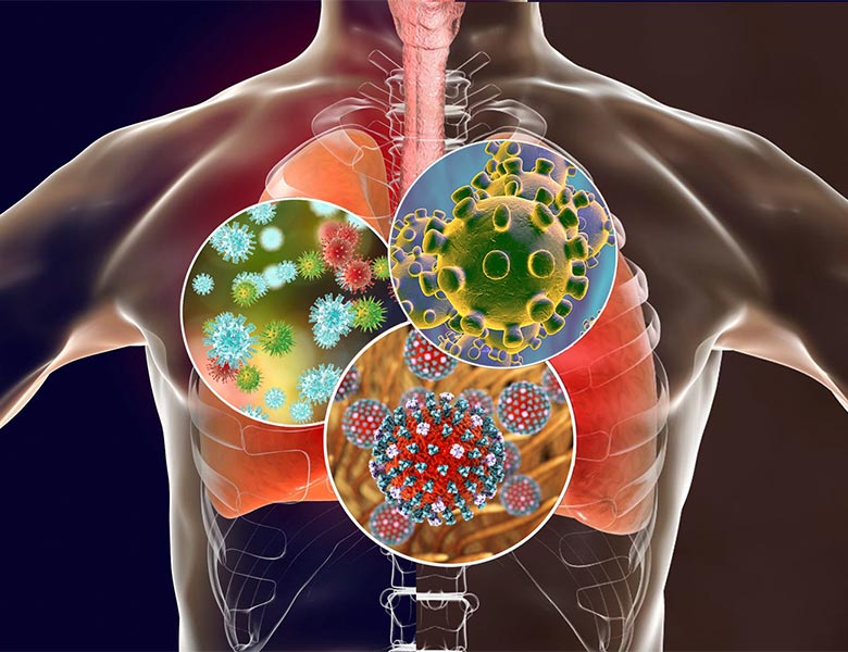 Infections respiratoires basses, protéger nos patients à risque en 10 points clés - Dr Benjamin DAVIDO (Garches)