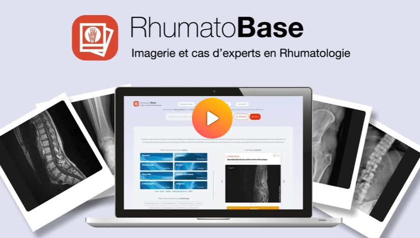 ressource rhumatobase