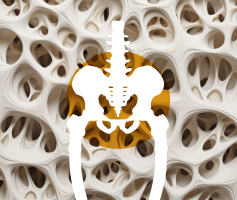 Anomalies de la minéralisation osseuse chez l’adulte
