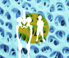 Anomalies de la minéralisation osseuse chez l’enfant