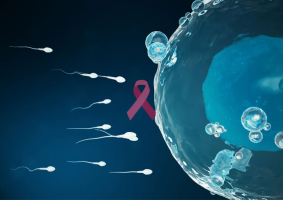 Quand et comment préserver la fertilité en pratique oncologique ?