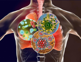 Infections respiratoires basses, protéger nos patients à risque en 10 points clés - Dr Benjamin DAVIDO (Garches)